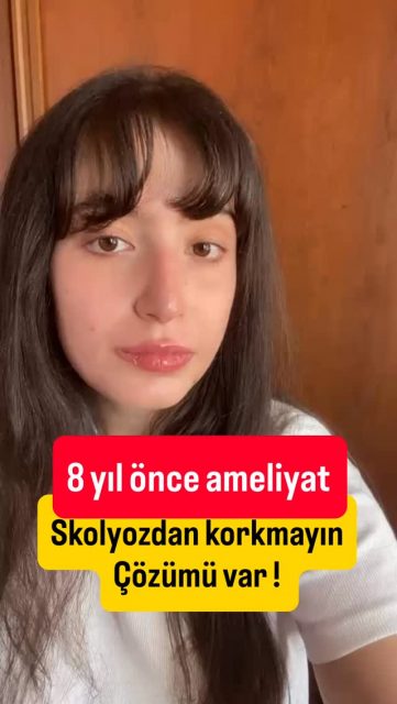 🎗️ Skolyoz Farkındalık Ayı

Bu videoda gördüğünüz gençlerin ve yetişkinlerin ortak bir hikâyesi var: Bir zamanlar skolyoz tanısı almış olmaları…

Bugün ise kendi cümleleriyle umut oluyorlar. Çünkü skolyoz bir son değil, doğru zamanda doğru tedaviyle aşılabilen bir yolculuktur.

✅ Skolyozdan korkmayın. Modern tanı ve tedavi yöntemleri sayesinde birçok hasta sağlıklı ve aktif yaşamına geri dönebilmektedir.

✅ Her skolyoz ameliyat gerektirmez. Düzenli takip, egzersiz ve korse tedavileri birçok hastada etkili sonuçlar sağlayabilir.

✅ Gerektiğinde cerrahi tedavi güvenle uygulanabilmektedir. Güncel teknolojiler, nöromonitörizasyon sistemleri ve gelişmiş cerrahi teknikler sayesinde başarılı sonuçlar elde edilmektedir.

✅ Tedavinin amacı sadece omurgayı düzeltmek değildir. Duruşu, dengeyi, solunumu, özgüveni ve yaşam kalitesini artırmaktır.

✅ Bu videodaki her gülümseme bir başarı hikâyesidir. Skolyozdan korkmak yerine onu tanımak, takip etmek ve gerektiğinde tedavi olmak en doğru yaklaşımdır.

Omurganız dik, geleceğiniz aydınlık olsun. 🌿

#skolyozfarkındalıkayı #skolyoz #scoliosis #omurgacerrahisi #scoliosisawareness omurgasağlığı profdrsinankahraman