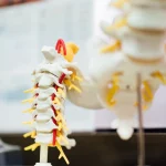 Omurga Dejenerasyonu ve Disk Hasarı: Sebepler, Belirtiler ve Etkili Tedavi Yöntemleri 5 Prof. Dr. Sinan Kahraman