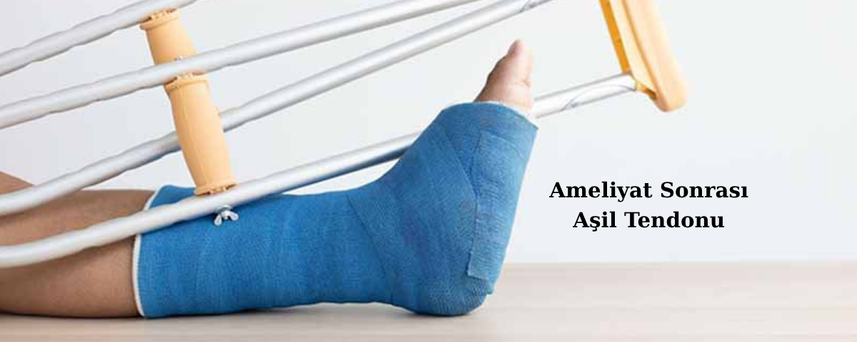Aşil Tendon Ameliyatı Sonrası 6 ameliyat sonrası aşil tendonu